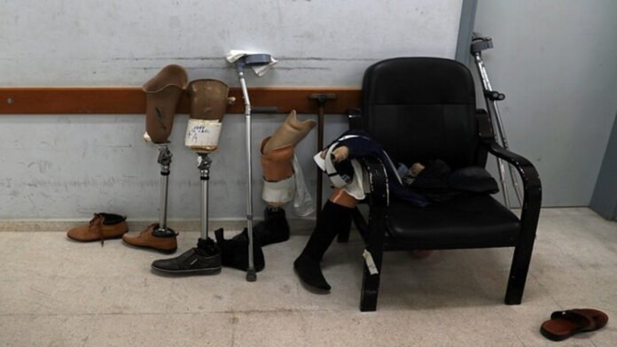 कृत्रिम अंग की देखभाल (Prosthetic care)